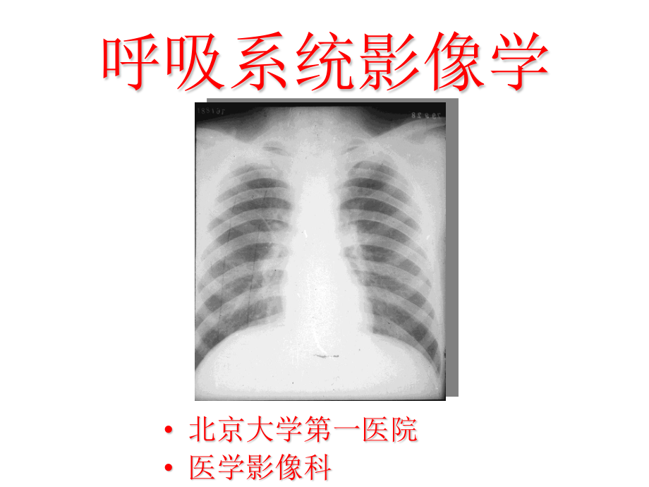 呼吸系统影像学第二部分.ppt_第1页