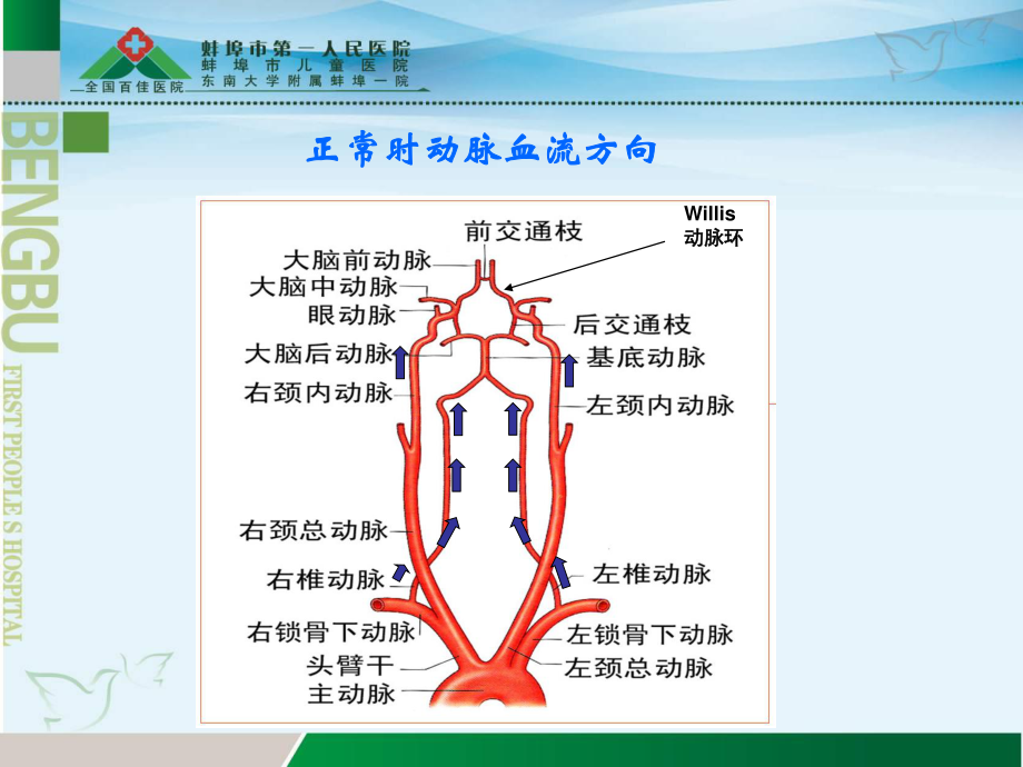 锁骨下动脉盗血综合征详解.ppt_第3页