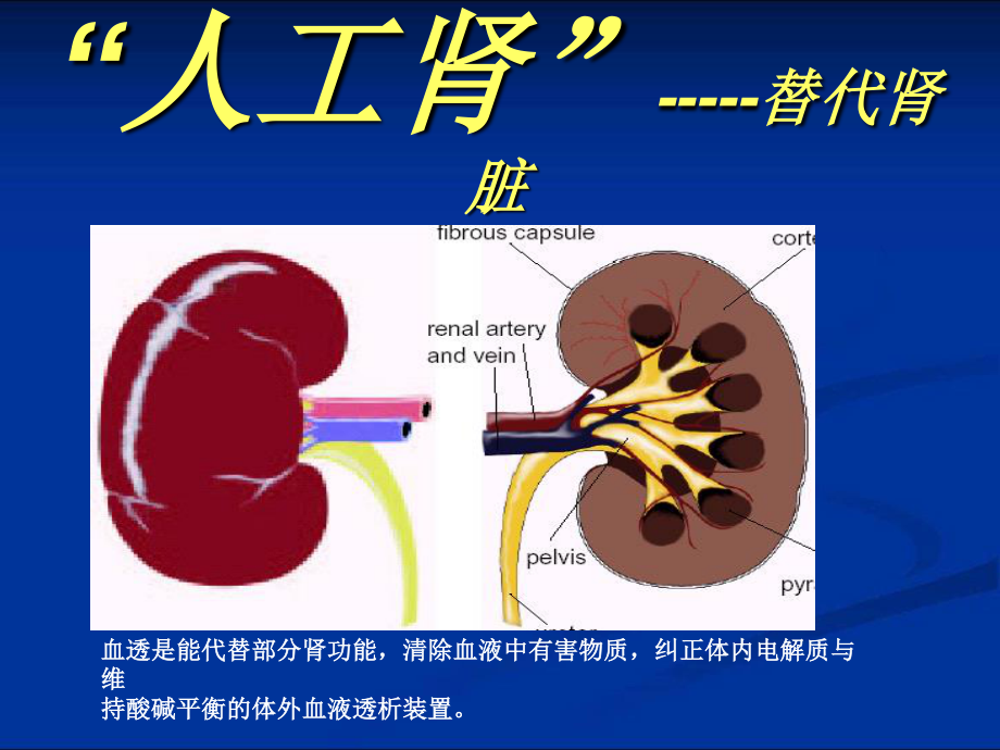 血液透析的血管通路.ppt_第2页