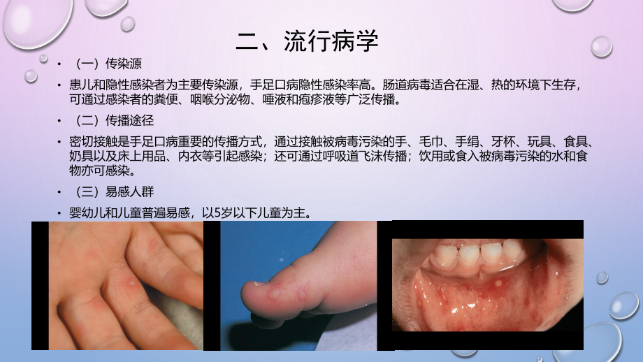 手足口病诊疗指南(2018年版).pptx_第3页