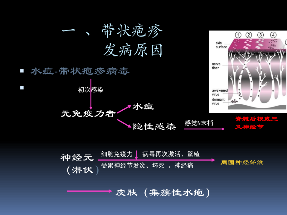 带状疱疹及后遗神经痛科普.pptx_第3页