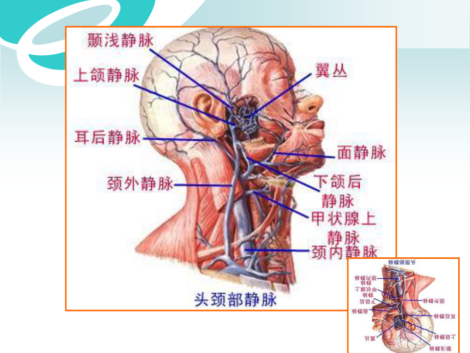 深静脉穿刺.ppt_第3页