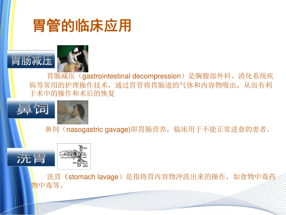 双腔胃管.ppt_第2页