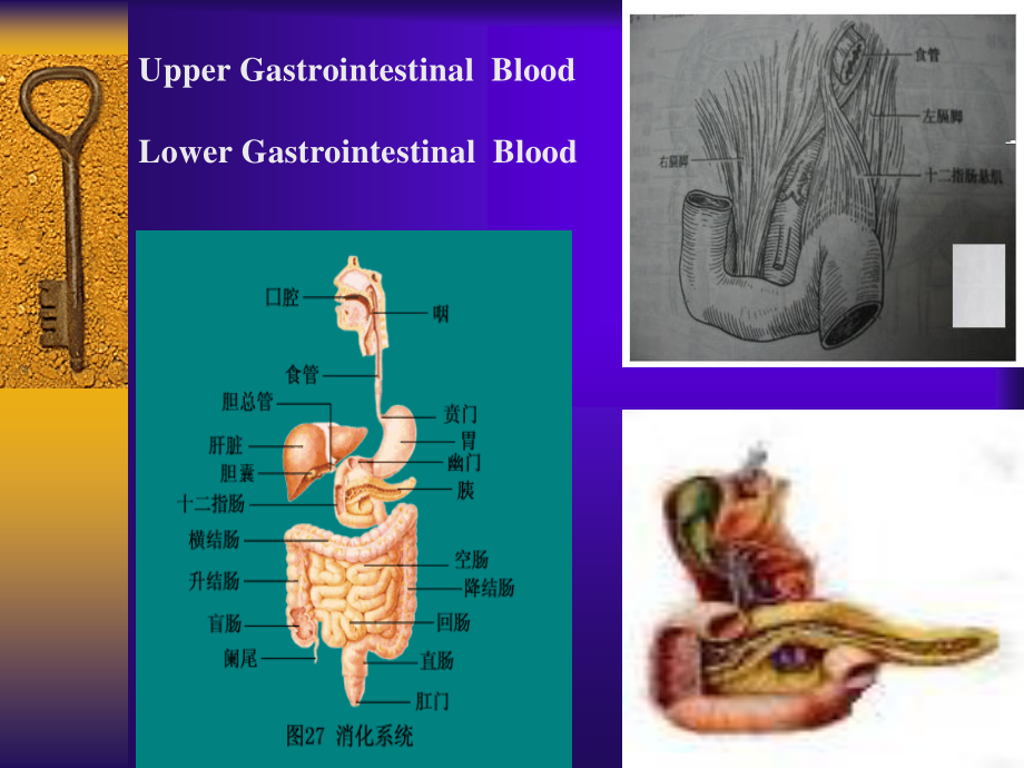 呕血便血2013.ppt_第2页