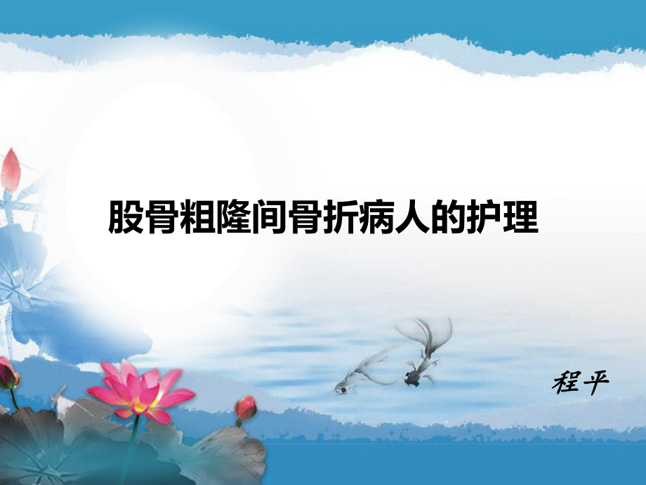 浅谈股骨粗隆间骨折.ppt_第1页