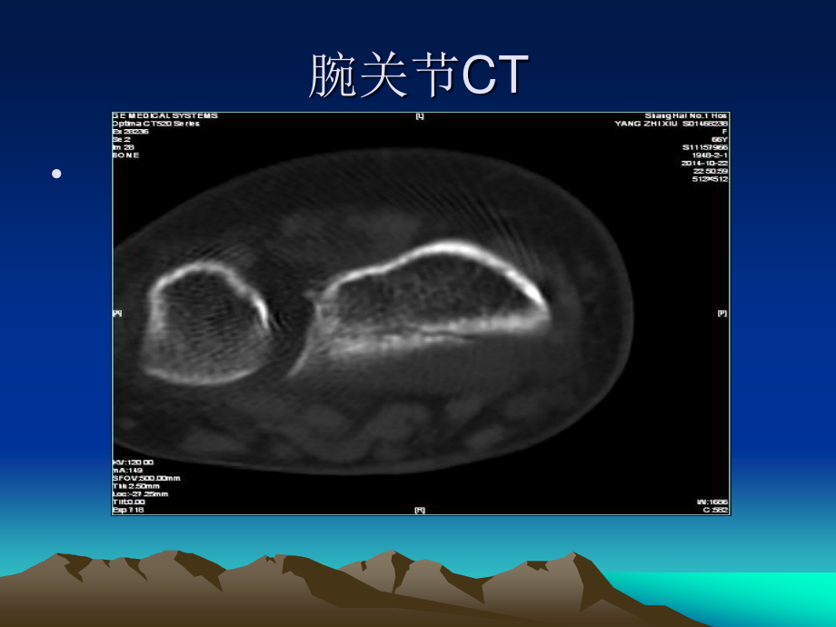 容易遗漏骨折.整理.ppt_第3页