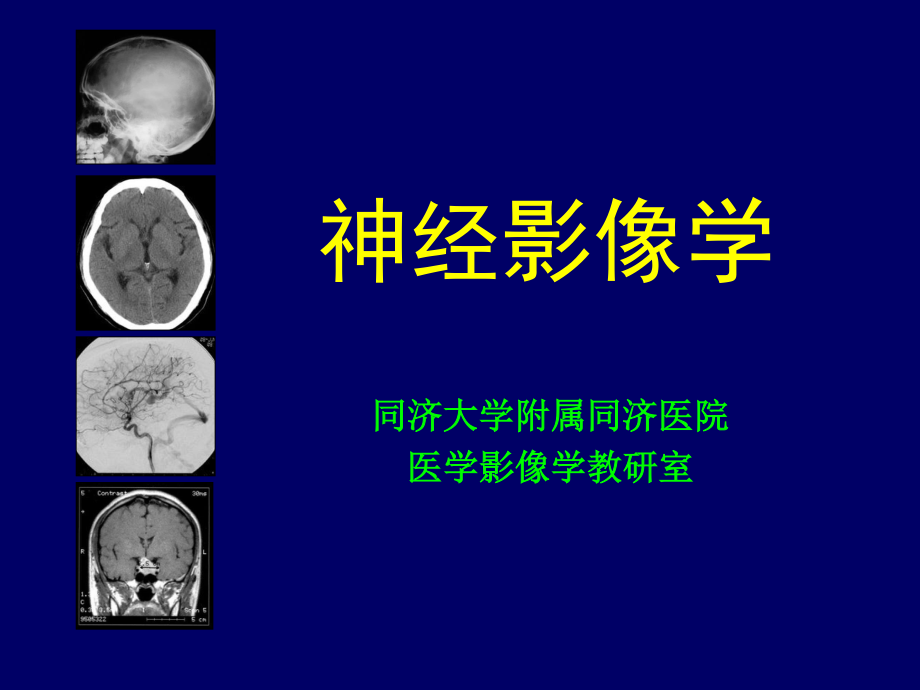 神经影像学--颅脑检查方法[1].ppt_第1页