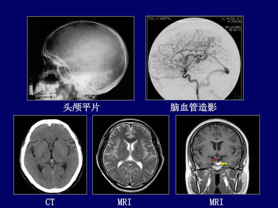 神经影像学--颅脑检查方法[1].ppt_第3页