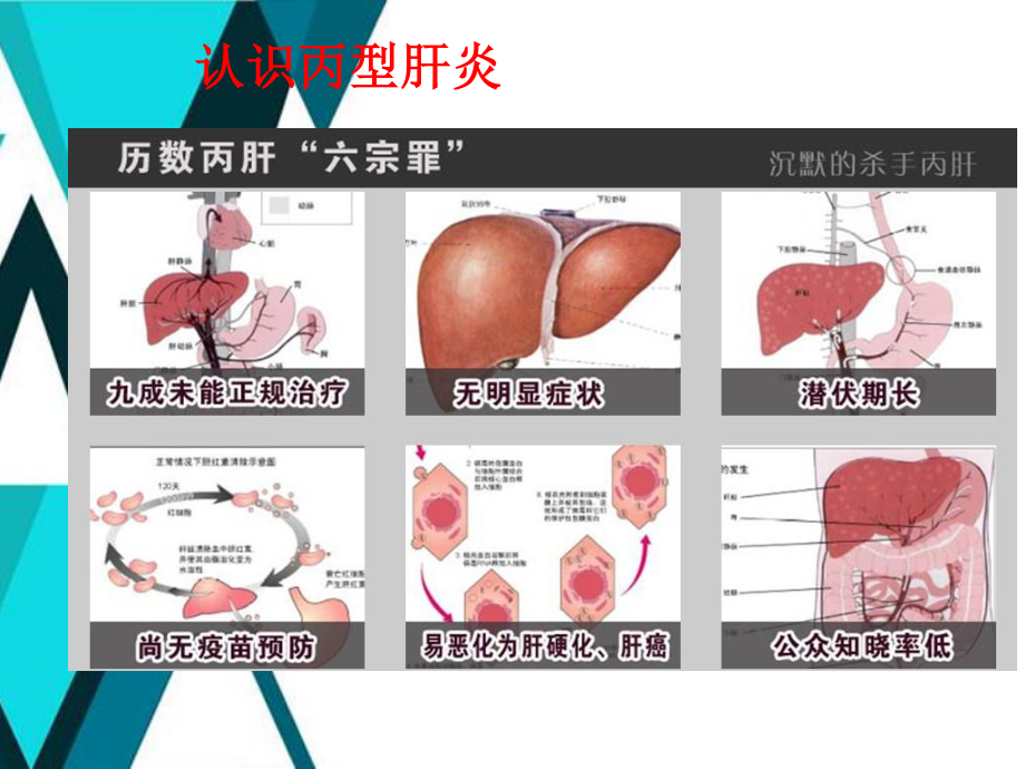 广州丙肝医院讲解如何防治丙型肝炎.ppt_第2页