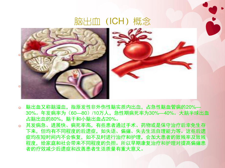 康复科业务查房.ppt_第3页