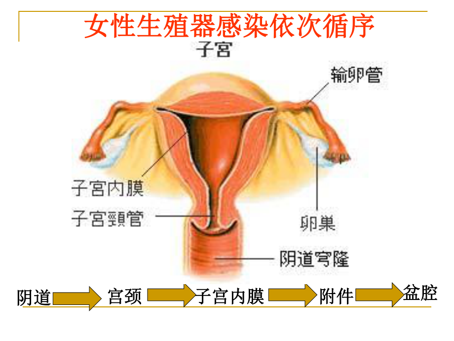 宫颈炎、副本炎、盆腔炎.ppt_第3页