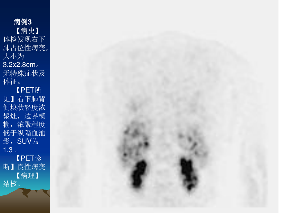 最新PET病例-PPT文档.ppt_第2页