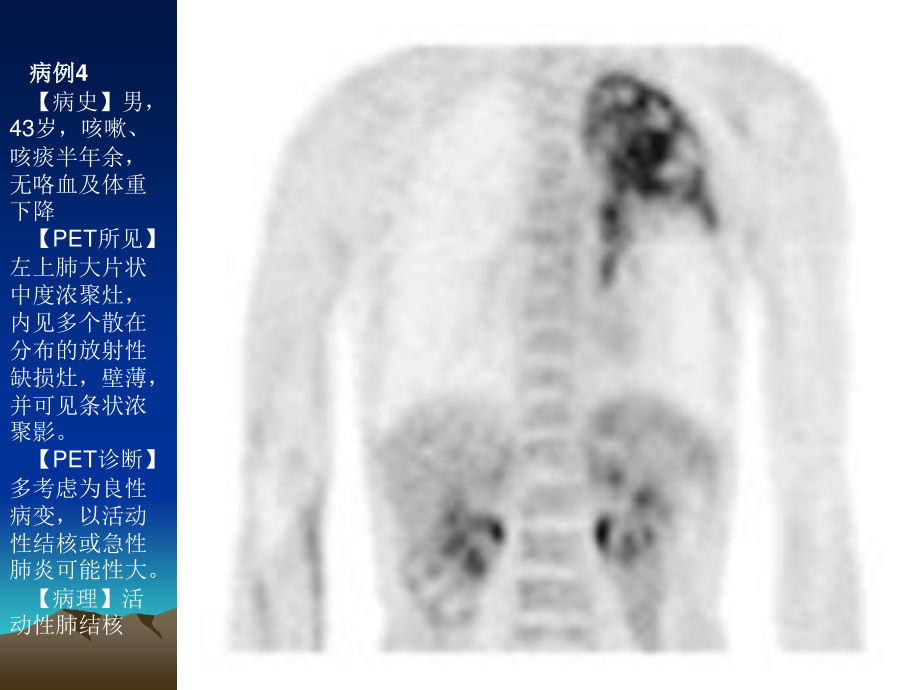 最新PET病例-PPT文档.ppt_第3页