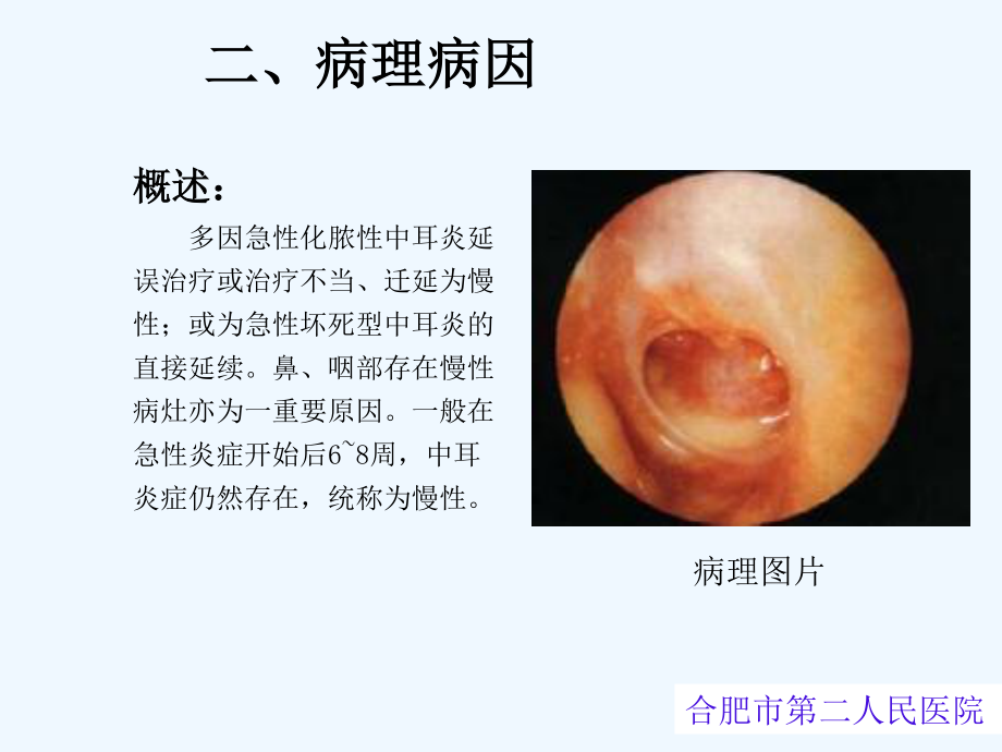 慢性化脓性中耳炎(1).ppt_第3页