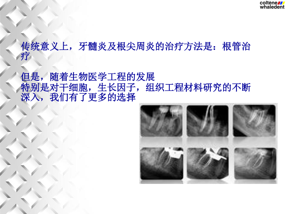 牙髓血运重建术.ppt_第2页