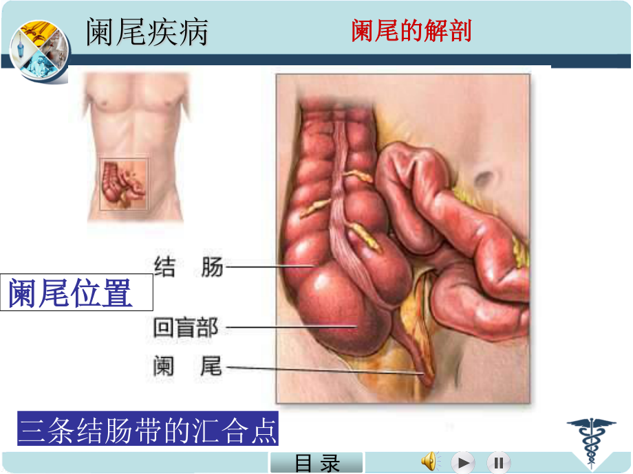 急性阑尾炎.PPT.ppt_第2页