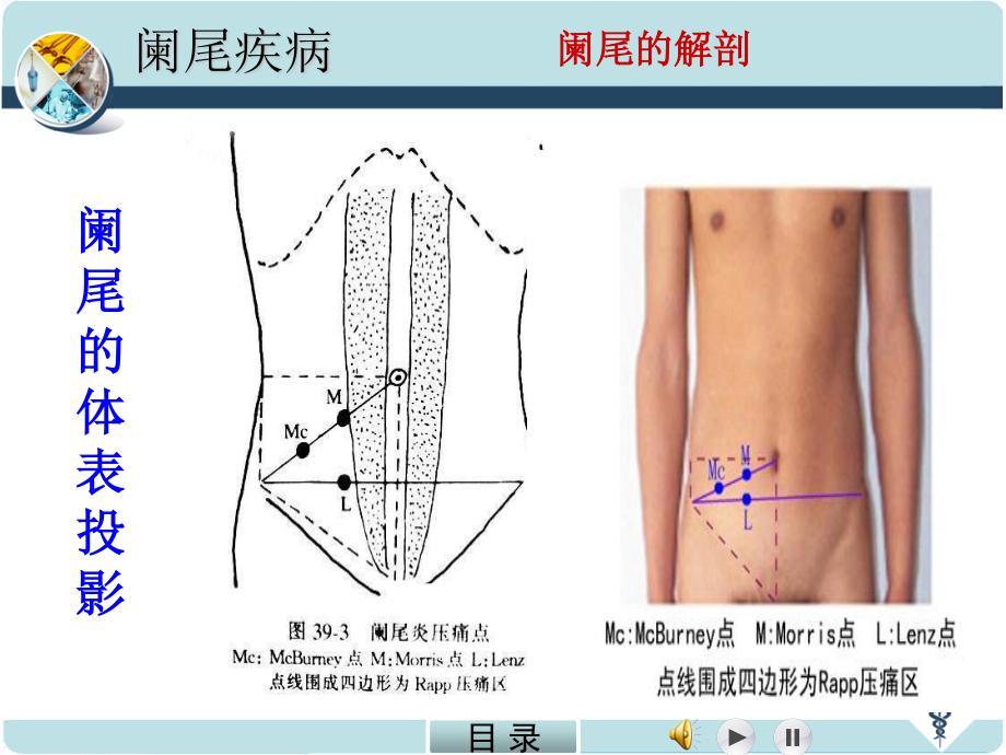 急性阑尾炎.PPT.ppt_第3页