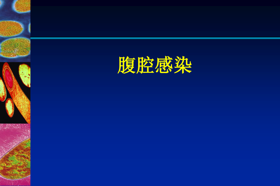 复杂性腹腔感染诊治.pptx_第1页