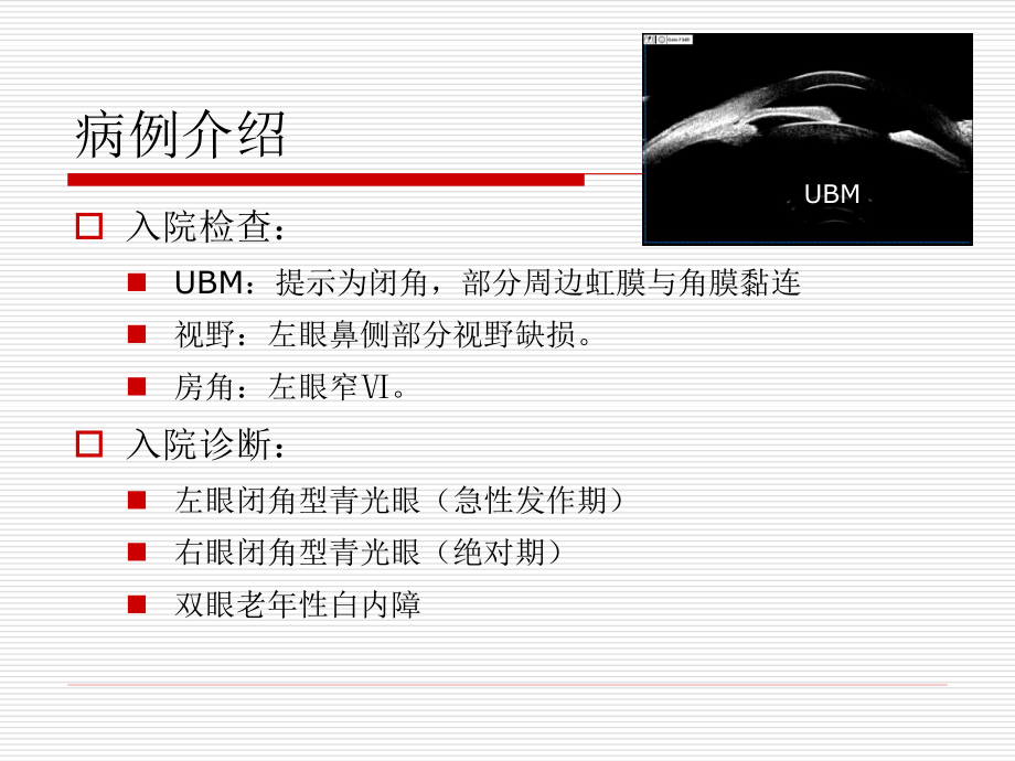 恶性青光眼病例分析讲诉.ppt_第3页