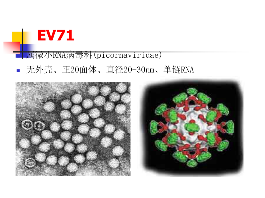 手足口病诊治中的神经系统相关问题(2010-08-30).ppt_第3页