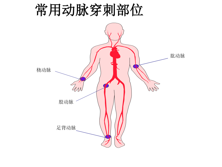 如何抽取动脉血..ppt_第2页