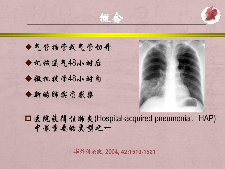 呼吸机相关性肺炎.pptx_第3页