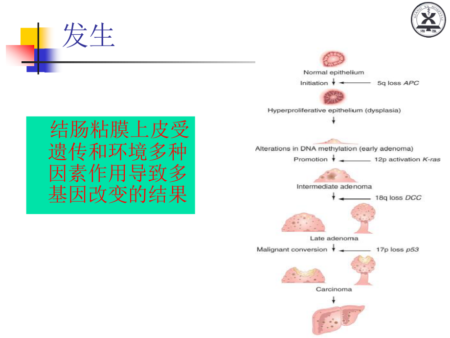 大肠癌晏教授讲义.ppt_第2页