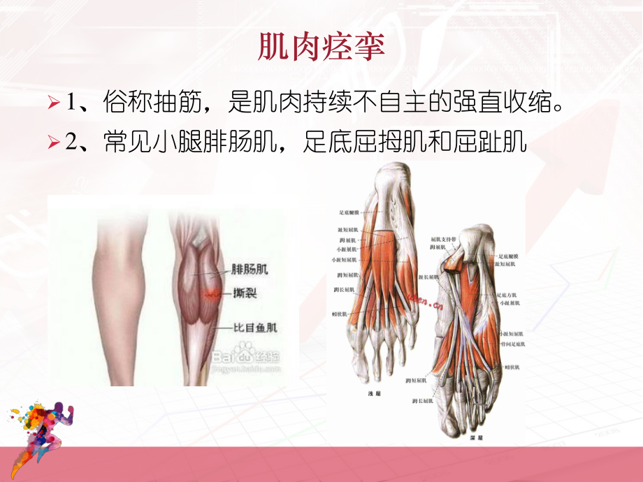 常见运动型病症.ppt_第2页