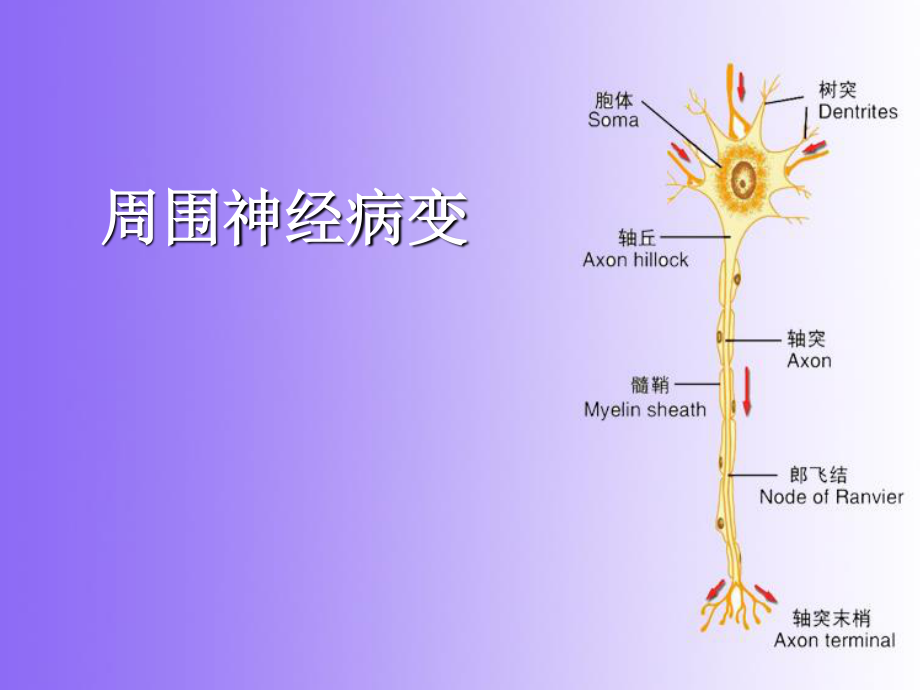 周围神经病变-oyf制作.ppt_第2页