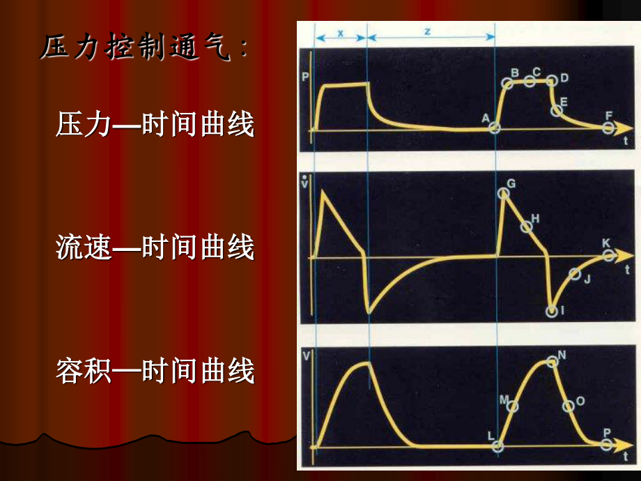 基础呼吸机波形分析.ppt_第3页