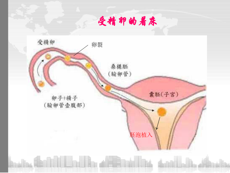 异位妊娠教学查房-最新.ppt_第3页