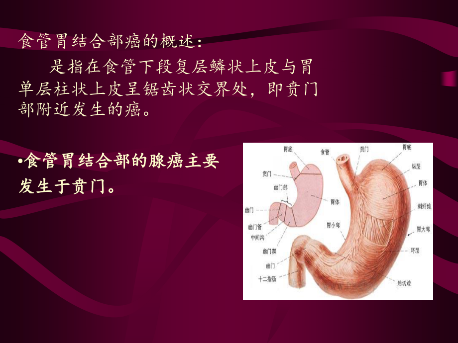 食道胃底结合部癌.ppt_第2页