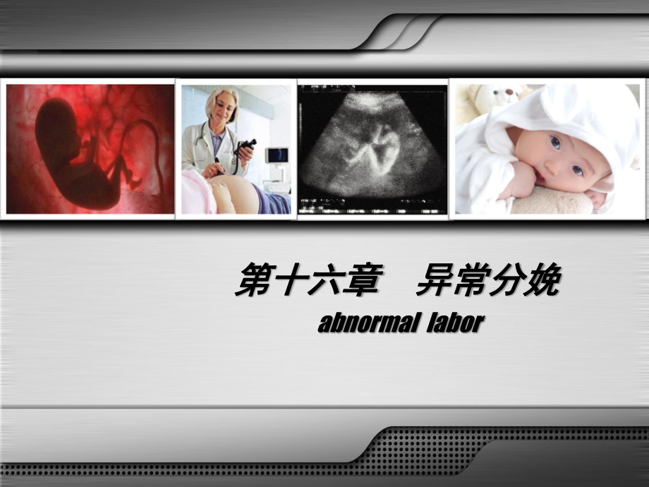 异常分娩-胎位异常.ppt_第1页