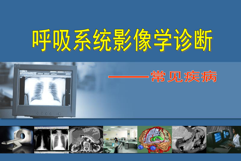 呼吸系统影像学.ppt_第1页