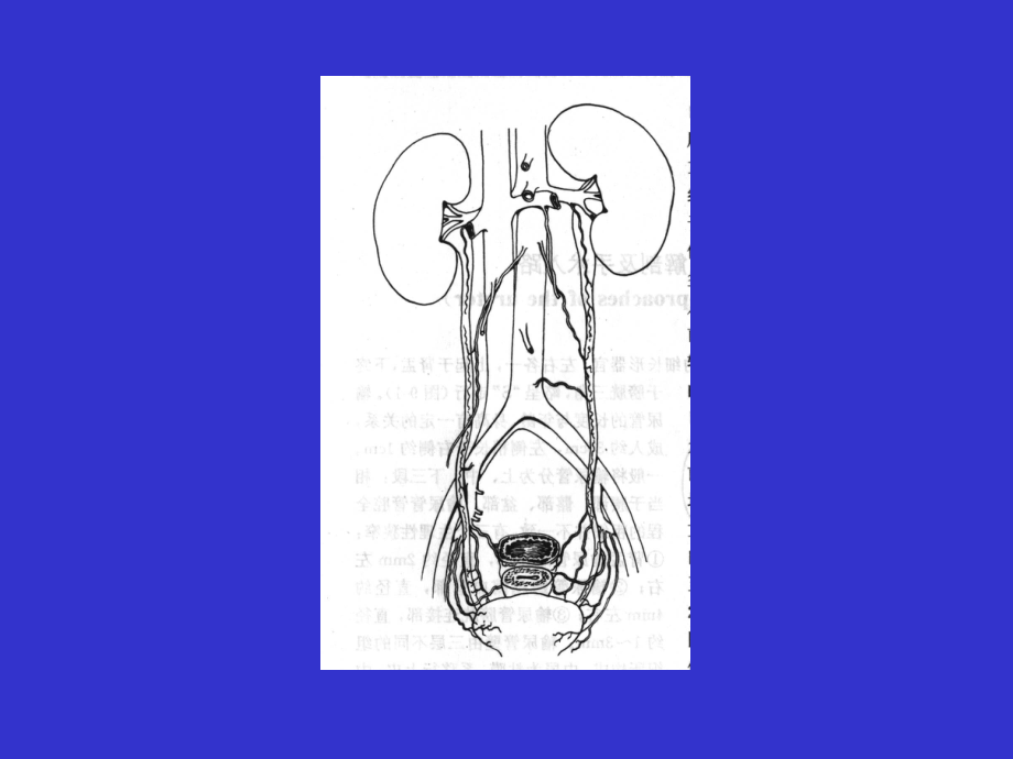 泌尿外科总论详解.ppt_第3页