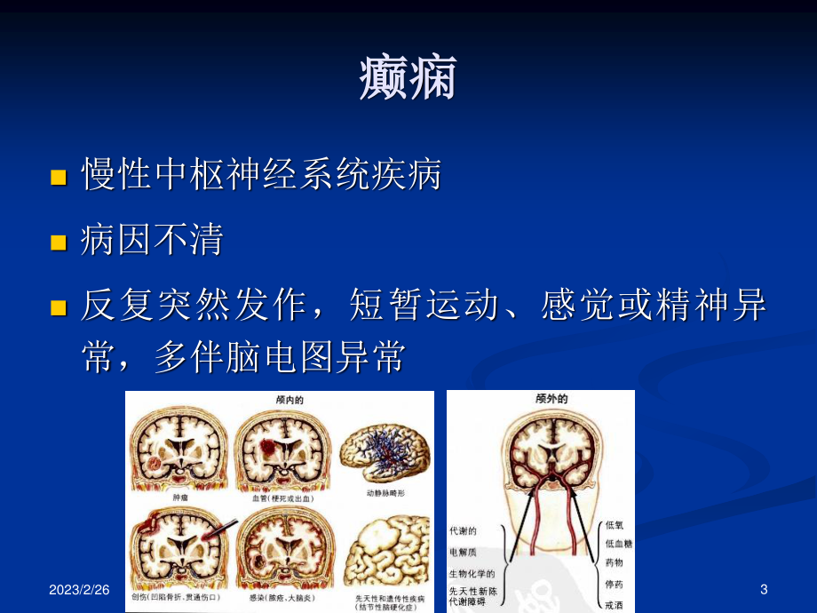 抗癫痫、抗惊厥药my.ppt_第3页