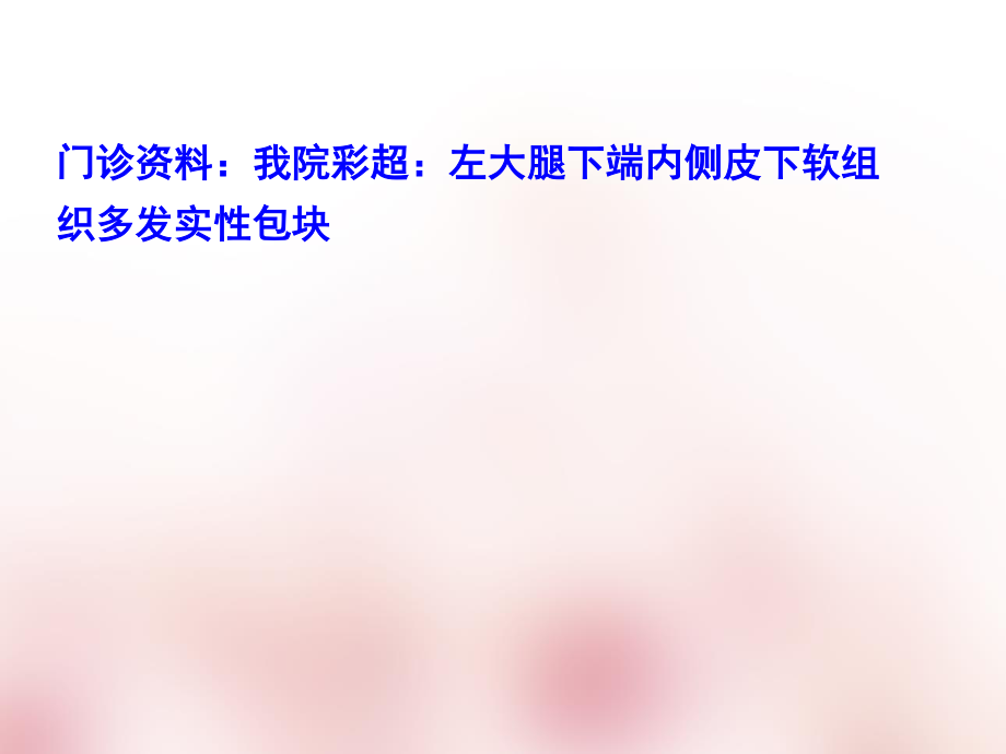 软组织血管瘤ppt.ppt_第3页