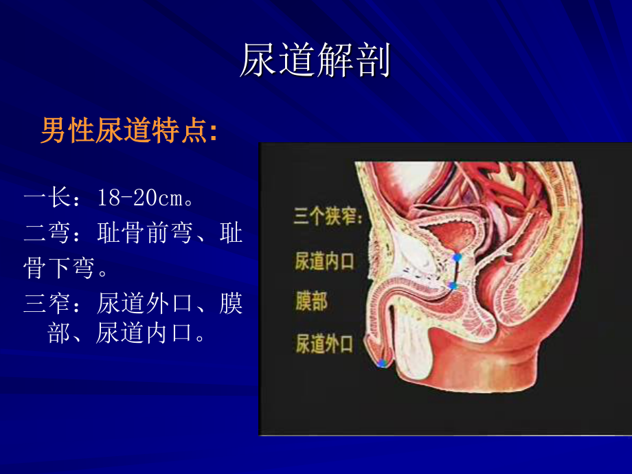 导尿及注意事项..ppt_第3页