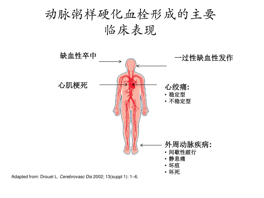 急性冠脉综合症的.ppt_第1页