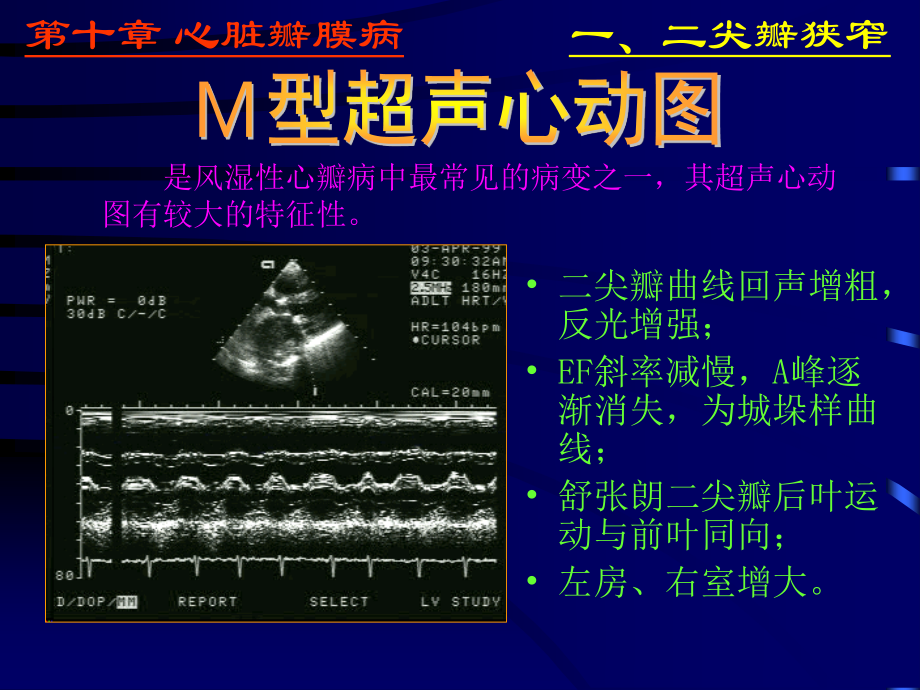 异常心脏ppt.ppt_第2页