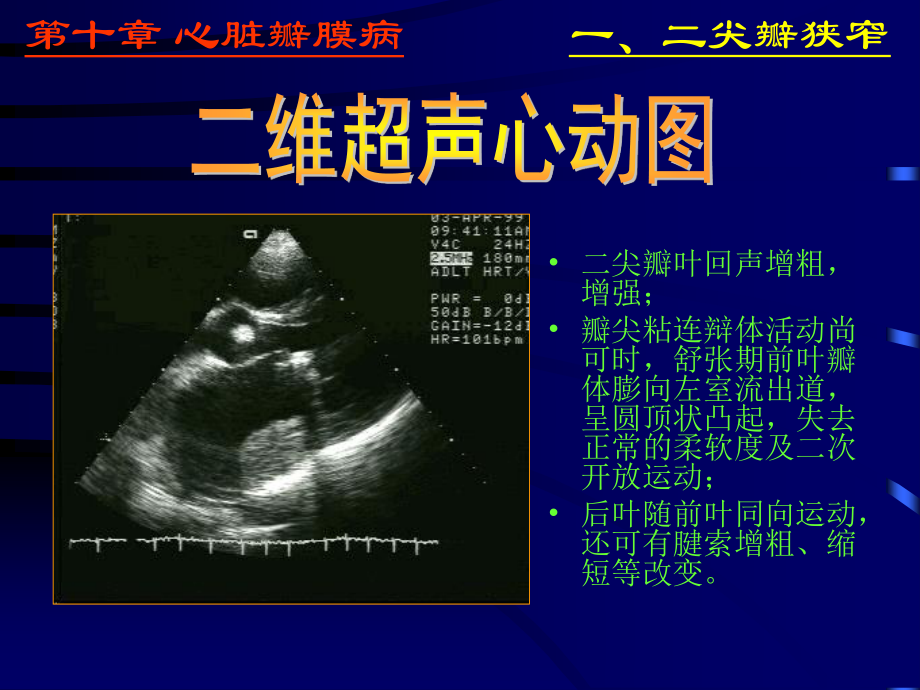 异常心脏ppt.ppt_第3页