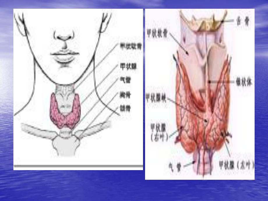 甲状腺全切除术.ppt_第3页