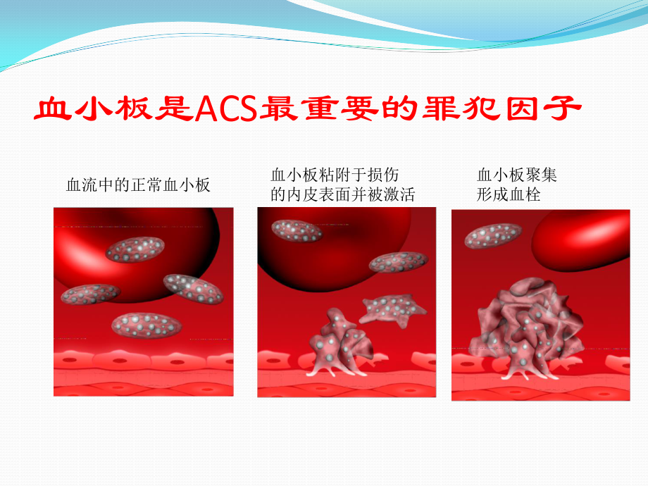 双抗消化道出血.pptx_第3页