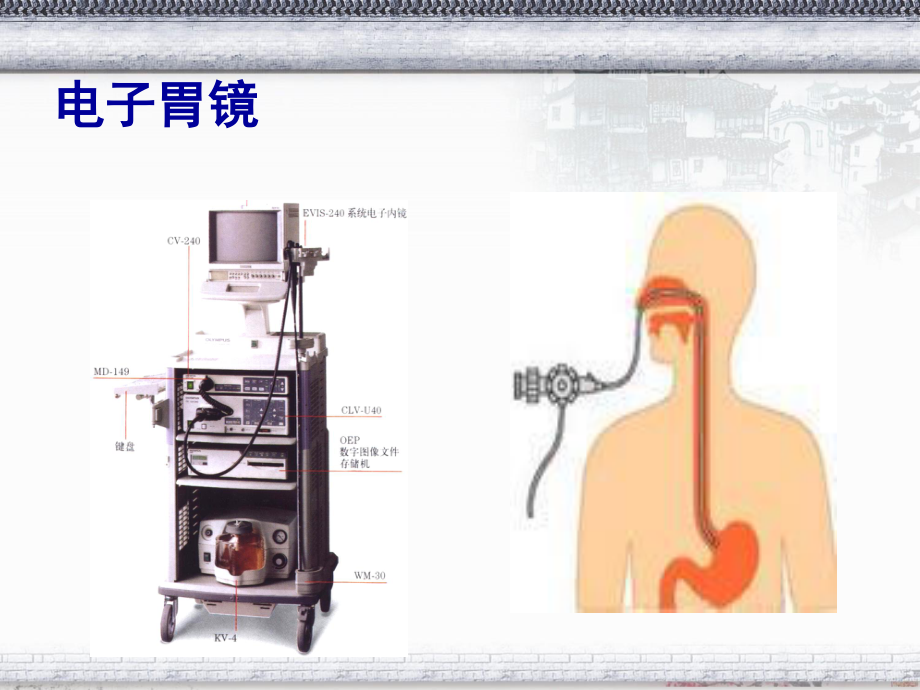 常见消化内镜的诊治.ppt_第3页