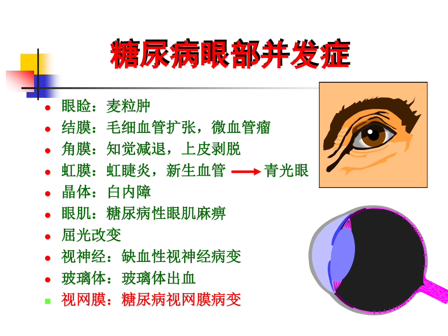 糖尿病视网膜病变1.ppt_第2页