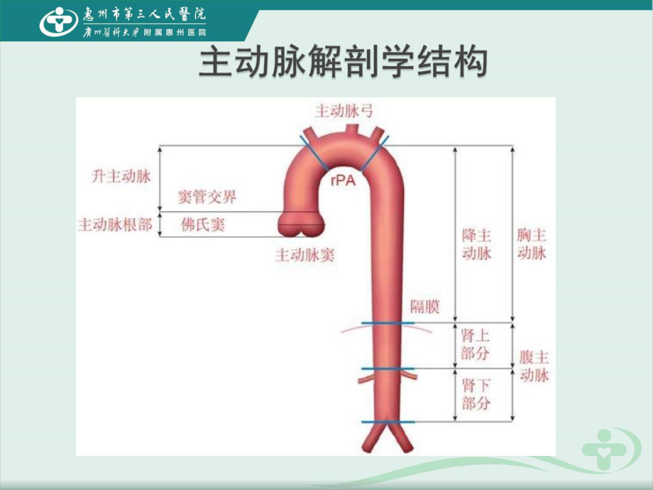 急性主动脉综合征的诊疗进展.ppt_第2页