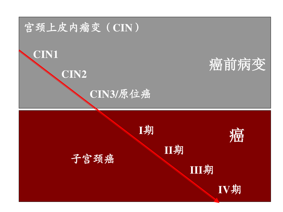 宫颈癌前病变的处理.ppt_第2页