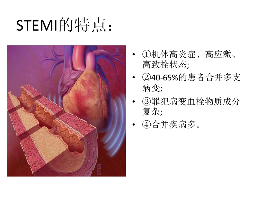 急诊PCI中同期还是分期处理非犯罪血管.pptx_第3页