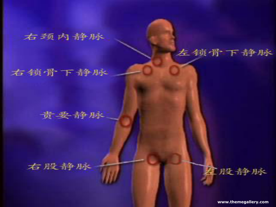 深静脉置管与PICC.ppt_第3页