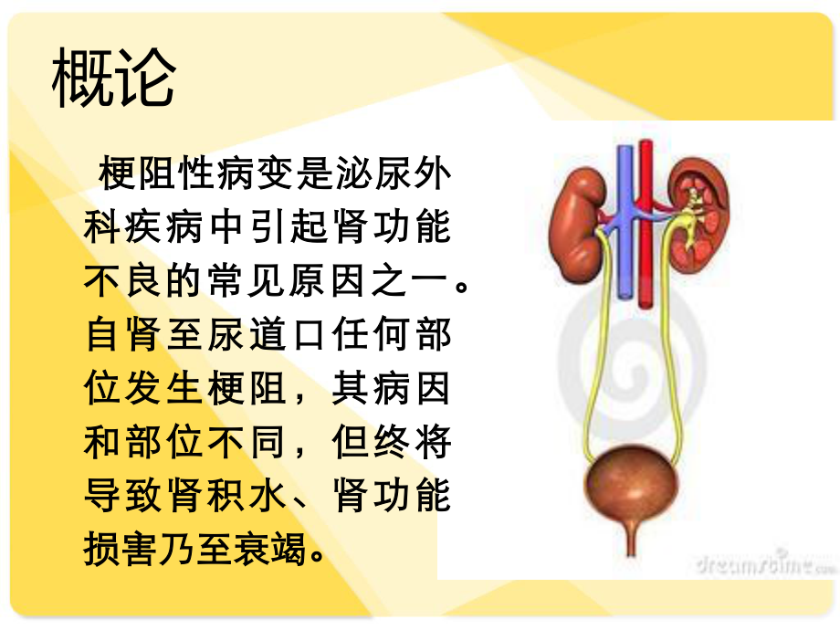 沁尿系统梗阻.ppt_第2页